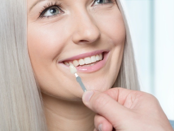 Woman's smile compared with veneers color option
