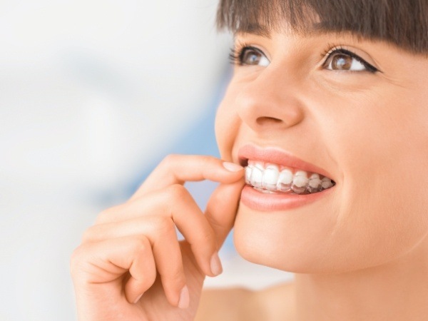 Woman placing Invisalign clear aligner tray