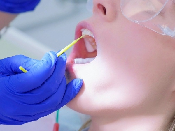 Dental patient receiving a fluoride treatment