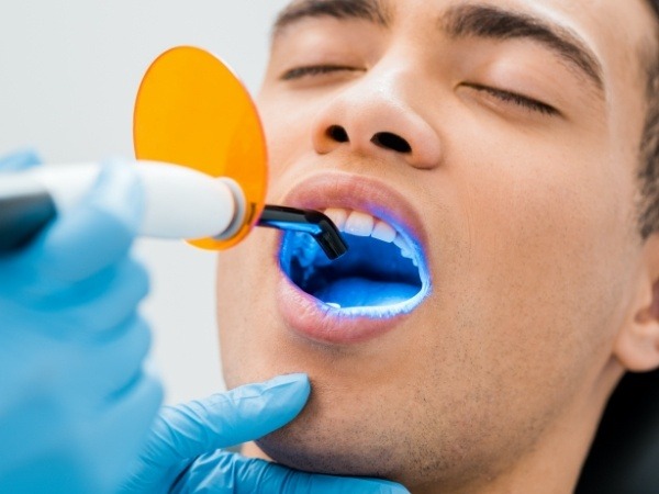 Dental patient receiving dental bonding on a front tooth
