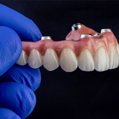 Implant denture