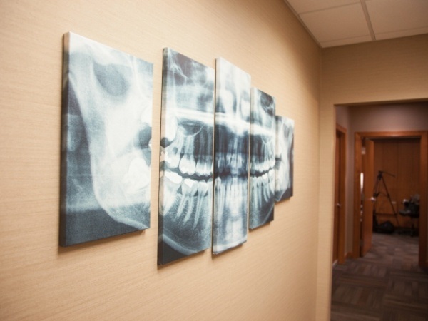 X ray of smile on dental office wall