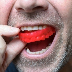 Man placing a protective mouthguard