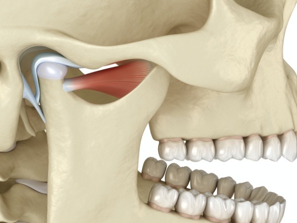 3 D image showing dysfunctional T M J