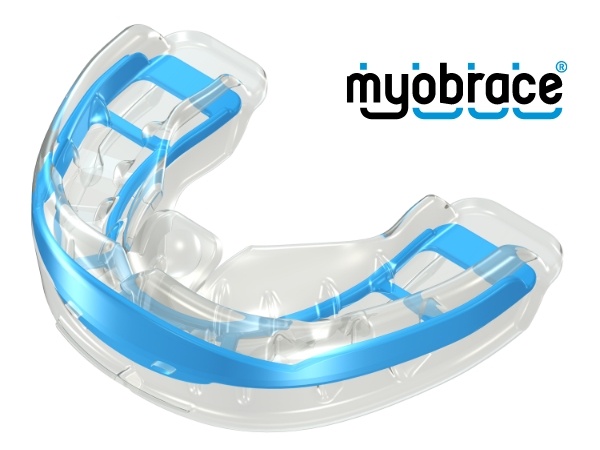 Myobrace oral appliance