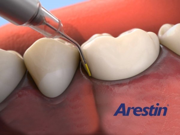 Animated smile during antibiotic therapy treatment