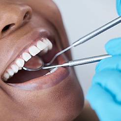 Dentist using tools to examine patient's teeth