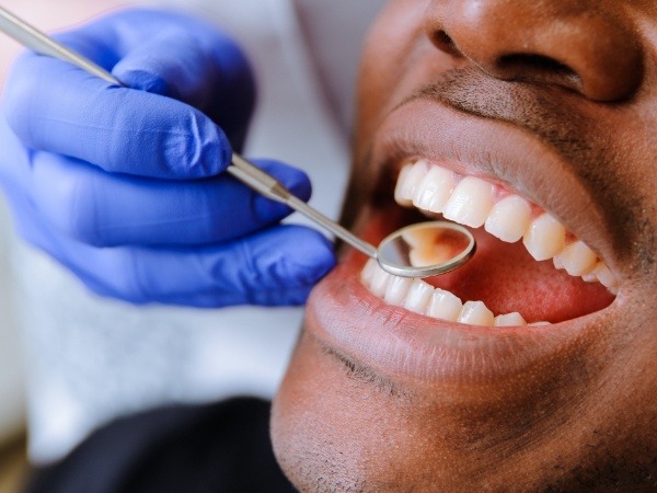 Dental patient receiving an oral cancer screening