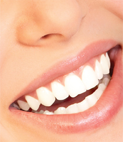 teeth_whitening1