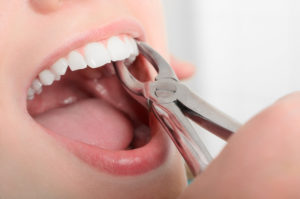 close-up of dental work