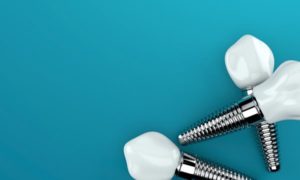 Dental implants against a blue background